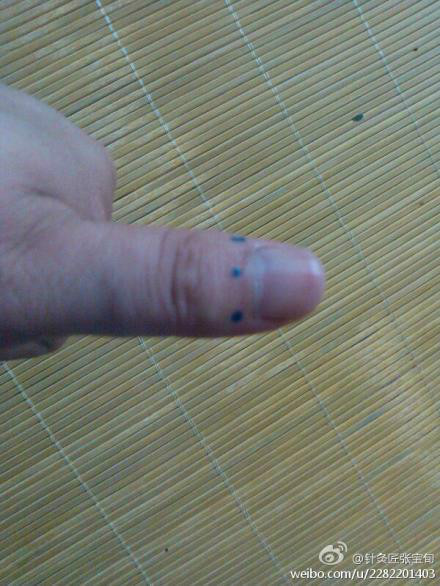 ��Ľ��ű�Ѯ����ҽѧ�ط����ܼ򵥣���Ч��! - Եˮ���� - 