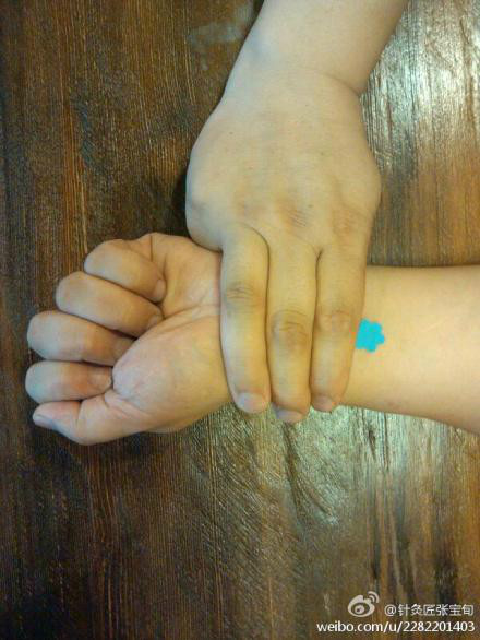 ��Ľ��ű�Ѯ����ҽѧ�ط����ܼ򵥣���Ч��! - Եˮ���� - 