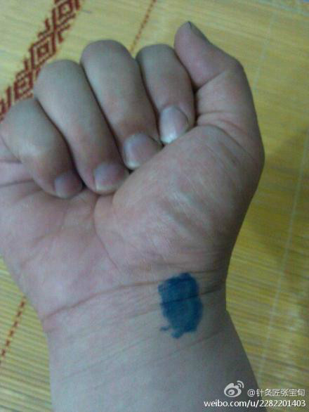 ��Ľ��ű�Ѯ����ҽѧ�ط����ܼ򵥣���Ч��! - Եˮ���� - 