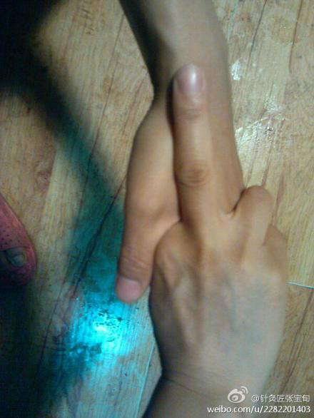 ��Ľ��ű�Ѯ����ҽѧ�ط����ܼ򵥣���Ч��! - Եˮ���� - 